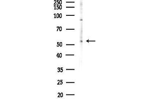 anti-K(lysine) Acetyltransferase 8 (KAT8) (N-Term) antibody