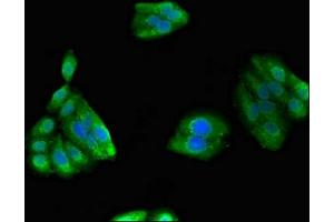 Immunofluorescent analysis of HepG2 cells using ABIN7162738 at dilution of 1:100 and Alexa Fluor 488-congugated AffiniPure Goat Anti-Rabbit IgG(H+L) (GIPC1 antibody  (AA 7-74))