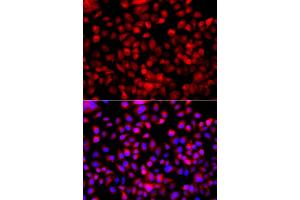 Immunofluorescence analysis of A549 cells using FASN antibody.