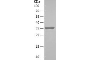 Western Blotting (WB) image for Peroxiredoxin 5 (PRDX5) (AA 102-214) protein (His-IF2DI Tag) (ABIN7282741) (Peroxiredoxin 5 Protein (PRDX5) (AA 102-214) (His-IF2DI Tag))