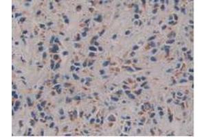 IHC-P analysis of Human Prostate Gland Tissue, with DAB staining. (FAM3C antibody  (AA 25-227))