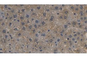 Detection of LRG1 in Rat Liver Tissue using Monoclonal Antibody to Leucine Rich Alpha-2-Glycoprotein 1 (LRG1) (LRG1 antibody  (AA 39-308))