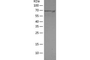 Western Blotting (WB) image for Itchy E3 Ubiquitin Protein Ligase Homolog (ITCH) (AA 197-542) protein (His-IF2DI Tag) (ABIN7123643)