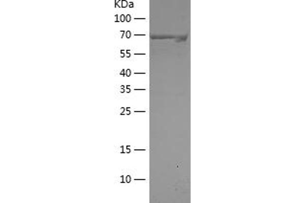 ITCH Protein (AA 197-542) (His-IF2DI Tag)