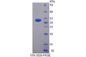 SDS-PAGE (SDS) image for Ubiquitin-Conjugating Enzyme E2S (UBE2S) (AA 1-209) protein (His tag) (ABIN6239559) (UBE2S Protein (AA 1-209) (His tag))