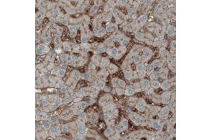 Immunohistochemical staining (Formalin-fixed paraffin-embedded sections) of human liver with ITIH4 monoclonal antibody, clone CL1858  shows immunoreactivity in sinusoids. (ITIH4 antibody)