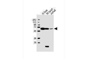 All lanes : Anti-PGM1 Antibody (C-Term) at 1:2000 dilution Lane 1: human liver lysate Lane 2: mouse heart lysate Lane 3: Jurkat whole cell lysate Lysates/proteins at 20 μg per lane. (Phosphoglucomutase 1 antibody  (AA 469-501))