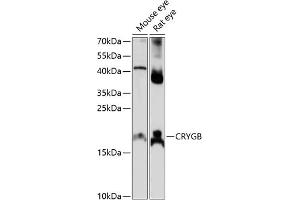Western blot analysis of extracts of various cell lines, using CRYGB antibody (ABIN7266531) at 1:1000 dilution. (CRYGB antibody  (AA 80-135))