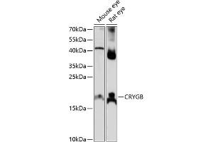 Western blot analysis of extracts of various cell lines, using CRYGB antibody (ABIN7266531) at 1:1000 dilution. (CRYGB antibody  (AA 80-135))