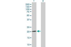 Western Blot analysis of NRSN2 expression in transfected 293T cell line by NRSN2 MaxPab polyclonal antibody. (NRSN2 antibody  (AA 1-204))
