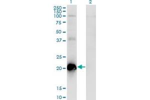 Western Blot analysis of TCAP expression in transfected 293T cell line by TCAP monoclonal antibody (M03), clone 1H3. (TCAP antibody  (AA 1-167))