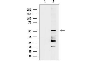 Western blot analysis of lysates from Rat muscle, using CHGA Antibody.
