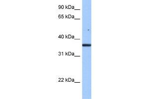 WB Suggested Anti-FAM153B Antibody Titration: 0. (FAM153B antibody  (Middle Region))