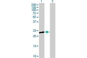 Western Blot analysis of PRTFDC1 expression in transfected 293T cell line by PRTFDC1 MaxPab polyclonal antibody. (PRTFDC1 antibody  (AA 1-225))