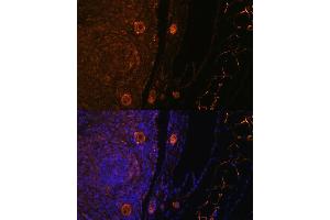 Immunofluorescence analysis of rat oophoroma cells using ZP3 antibody (ABIN6130818, ABIN6150537, ABIN6150539 and ABIN6224382) at dilution of 1:100. (Zona Pellucida Glycoprotein 3 antibody  (AA 170-390))