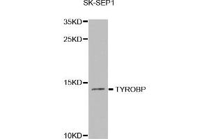 Western Blotting (WB) image for anti-TYRO Protein tyrosine Kinase Binding Protein (TYROBP) antibody (ABIN1876573) (TYROBP antibody)