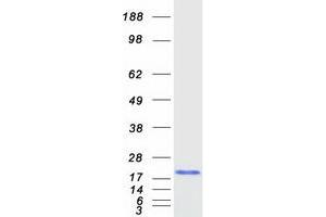 Western Blotting (WB) image for Baculoviral IAP Repeat-Containing 5 (BIRC5) (Transcript Variant 1) protein (Myc-DYKDDDDK Tag) (ABIN2723222)