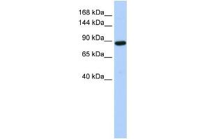 WB Suggested Anti-HACE1 Antibody Titration:  0. (HACE1 antibody  (Middle Region))