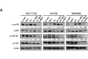 Western Blotting (WB) image for anti-Actin, gamma 1 (ACTG1) (N-Term) antibody (ABIN2855174)