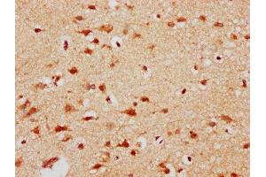 IHC image of ABIN7150950 diluted at 1:300 and staining in paraffin-embedded human brain tissue performed on a Leica BondTM system. (CBX4 antibody  (AA 1-160))