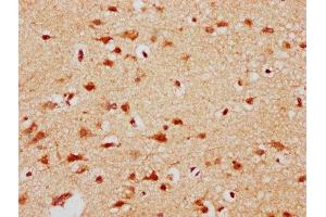 IHC image of ABIN7150950 diluted at 1:300 and staining in paraffin-embedded human brain tissue performed on a Leica BondTM system.