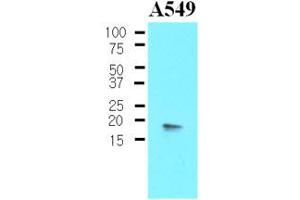 Western Blotting (WB) image for anti-Protein Phosphatase 1, Regulatory (Inhibitor) Subunit 14A (PPP1R14A) (AA 1-147), (N-Term) antibody (ABIN302213) (CPI-17 antibody  (N-Term))