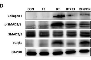 Increased DIO2 expression in lung tissue after radiation treatment and inhibition of the TGF-β1 signaling pathway by thyroid hormone. (GAPDH antibody)