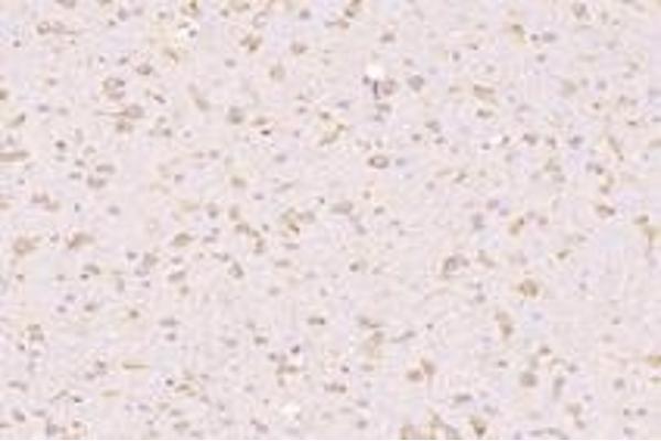 FASTKD3 antibody