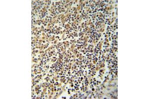 NLRP3 Antibody (N-term) (ABIN652504 and ABIN2842339) immunohistochemistry analysis in formalin fixed and paraffin embedded human lymph tissue followed by peroxidase conjugation of the secondary antibody and DAB staining. (NLRP3 antibody  (N-Term))
