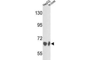 Western Blotting (WB) image for anti-Complement Factor B (CFB) antibody (ABIN3003162)