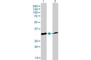 Western Blot analysis of PPIE expression in transfected 293T cell line by PPIE monoclonal antibody (M02), clone 2F5.