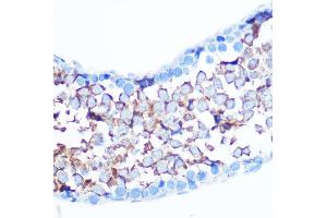 Immunohistochemistry (IHC) image for anti-Yes-Associated Protein 1 (YAP1) (Ser127) antibody (ABIN7271415)