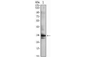 Western Blot showing CDC2 antibody used against Jurkat (1) cell lysate. (CDK1 antibody)