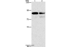 Western blot analysis of A431 and Raji cell, using CD2AP Polyclonal Antibody at dilution of 1:1000 (CD2AP antibody)