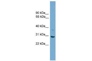 Western Blot showing SFN antibody used at a concentration of 1-2 ug/ml to detect its target protein. (14-3-3 sigma/SFN antibody  (N-Term))