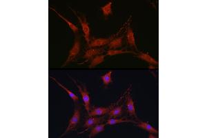 Immunofluorescence analysis of C6 cells using SLC4 / NBC Rabbit pAb (ABIN6129130, ABIN6148013, ABIN6148014 and ABIN6220962) at dilution of 1:100 (40x lens). (SLC4A4 antibody  (AA 1-240))