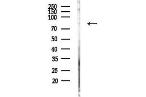 Western blot analysis of lysates from PC12 cells(heat-shock, 45 min treatment), using Phospho-Caldesmon (Ser789) Antibody at 1/1000 dilution.