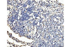 IHC analysis of PLD3 using anti-PLD3 antibody (ABIN7599439). (PLD3 antibody  (AA 1-490))