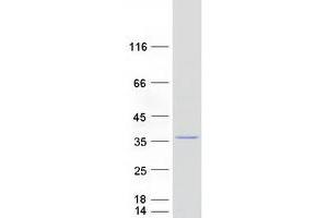 Mitochondrial Ribosomal Protein L28 (MRPL28) protein (Myc-DYKDDDDK Tag)
