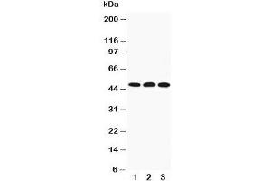Western blot testing of HYAL3 antibody and Lane 1:  22RV;  2: HeLa;  3: V20S cell lysate.