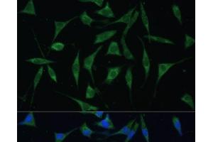 Immunofluorescence analysis of L929 cells using PALD1 Polyclonal Antibody at dilution of 1:100 (40x lens). (KIAA1274 antibody)