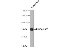Western blot analysis of extracts of mouse liver, using PRKRA/PACT antibody (ABIN6130639, ABIN6146220, ABIN6146221 and ABIN6221069) at 1:1000 dilution. (PRKRA antibody  (AA 1-313))