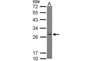 AP19035PU-N Ran BP1 antibody staining of Mouse brain (A) whole cell lysate (50 µg) at 1/1000 dilution, 12% SDS PAGE. (RANBP1 antibody  (N-Term))