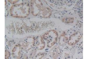 IHC-P analysis of Human Kidney Tissue, with DAB staining. (ABCC8 antibody  (AA 679-929))