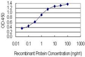 Detection limit for recombinant GST tagged ASH1L is 0. (ASH1L antibody  (AA 2859-2967))