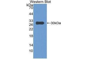 Western Blotting (WB) image for anti-Insulin-Like Growth Factor Binding Protein 4 (IGFBP4) (AA 23-259) antibody (ABIN1859308) (IGFBP4 antibody  (AA 23-259))