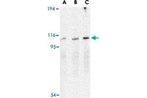 Western blot analysis of ERN1 in A-20 cell lysate with ERN1 polyclonal antibody  at (A) 0. (ERN1 antibody  (C-Term))