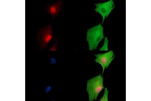ABIN7097004 and ABIN7101071 staining  cells by IF/ICC.