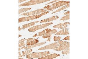 Immunohistochemistry (Paraffin-embedded Sections) (IHC (p)) image for anti-Keratocan (KERA) (AA 228-257), (C-Term) antibody (ABIN656548)