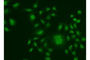 Immunofluorescence analysis of HeLa cells using ERCC1 antibody (ABIN5973037). (ERCC1 antibody)